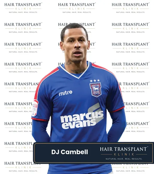 Celebrity client at Hair Transplant Klinik