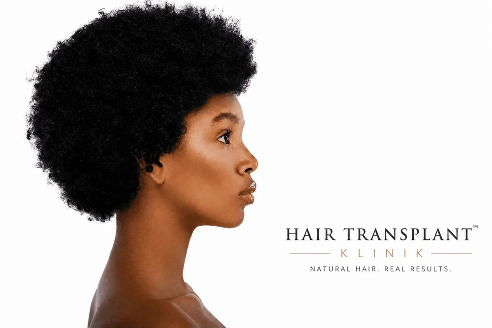 Afro hair transplant for women at Hair Transplant Klinik